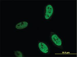 Anti-HEYL Mouse Monoclonal Antibody [clone: 4A11]