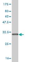 Anti-SLC5A2 Mouse Monoclonal Antibody [clone: 3G8]