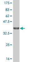 Anti-MUSK Mouse Monoclonal Antibody [clone: 4C12]