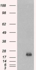 HEK293 overexpressing BAALC (RC203701) and probed with Anti-BAALC Antibody (A83225) (mock transfection in first lane), tested by Origene