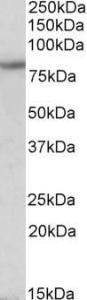 Anti-HCN3 antibody