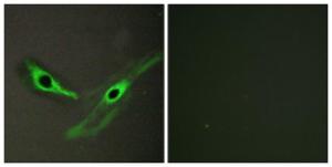 Immunofluorescence analysis of HeLa cells using Anti-ICK Antibody. The right hand panel represents a negative control, where the antibody was pre-incubated with the immunising peptide.