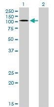 Anti-EPHA3 Mouse Monoclonal Antibody [clone: 3A12]