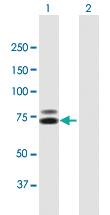 Anti-TDRD3 Mouse Polyclonal Antibody