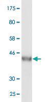 Anti-VPS25 Mouse Monoclonal Antibody [clone: 4D6-2D4]