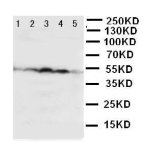 Anti-HSC70 Interacting Protein HIP Rabbit Polyclonal Antibody