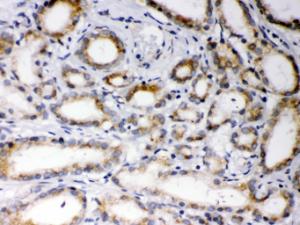 Anti-EBAG9 Rabbit Polyclonal Antibody