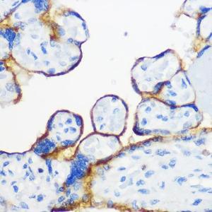 Immunohistochemistry analysis of paraffin-embedded human placenta using Anti-Fyn Antibody (A309065) at a dilution of 1:100 (40X lens). Perform microwave antigen retrieval with 10 mM Tris/EDTA buffer pH 9.0 before commencing with IHC staining protocol