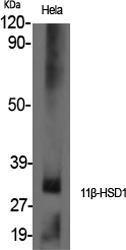 Anti-HSD11B1 antibody