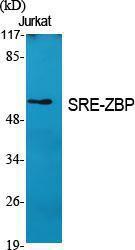 Antibody anti-ZNF187 100 µg