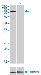 Anti-EPHA3 Mouse Monoclonal Antibody [clone: 3A12]