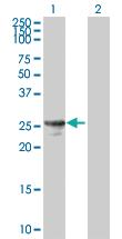 Anti-HPGD Mouse Polyclonal Antibody