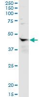 Anti-NR1I3 Polyclonal Antibody Pair