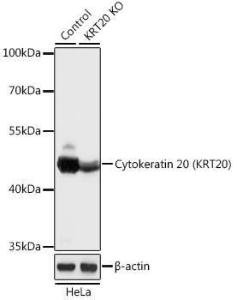 Western blot analysis of extracts from normal (control) and Cytokeratin 20 (Cytokeratin 20 (KRT20)) knockout (KO) HeLa cells, using Anti-Cytokeratin 20 Antibody (A92935) at 1:1,000 dilution