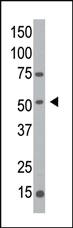 Anti-MGAT1 Rabbit Polyclonal Antibody