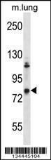 Anti-ADRBK2 Rabbit Polyclonal Antibody (APC (Allophycocyanin))