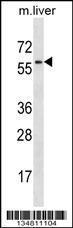 Anti-MAP2K7 Rabbit Polyclonal Antibody (HRP (Horseradish Peroxidase))