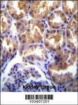 Anti-TRPM6 Rabbit Polyclonal Antibody (AP (Alkaline Phosphatase))