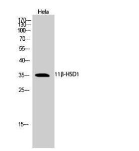 Anti-HSD11B1 antibody