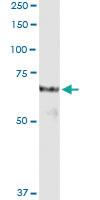 Anti-PROS1 Polyclonal Antibody Pair