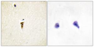 Immunohistochemical analysis of paraffin-embedded human brain tissue using Anti-ICK Antibody. The right hand panel represents a negative control, where the antibody was pre-incubated with the immunising peptide.