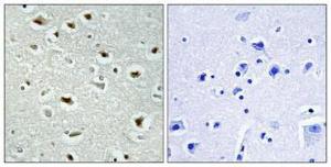 Antibody anti-ZNF187 100 µg