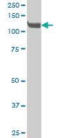 Anti-EPHA3 Mouse Monoclonal Antibody [clone: 3E9]