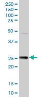 Anti-HPGD Mouse Polyclonal Antibody