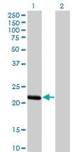 Anti-BCL2L10 Mouse Monoclonal Antibody [clone: 1B11]