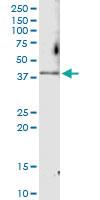 Anti-CDK6 Polyclonal Antibody Pair