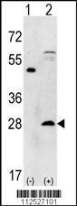 Anti-PSMA5 Rabbit Polyclonal Antibody