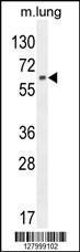 Anti-NFE2L1 Rabbit Polyclonal Antibody