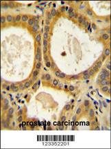 Anti-CTLA4 Rabbit Polyclonal Antibody