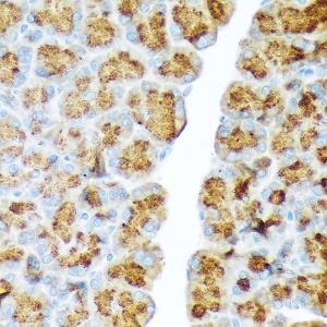 Immunohistochemistry analysis of paraffin-embedded rat pancreas using Anti-CTRL Antibody [ARC2218] (A306145) at a dilution of 1:100 (40x lens). Perform microwave antigen retrieval with 10 mM Tris/EDTA buffer pH 9.0 before commencing with IHC staining protocol