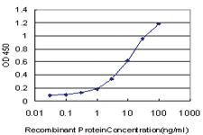 Anti-EPHA3 Mouse Monoclonal Antibody [clone: 3E9]