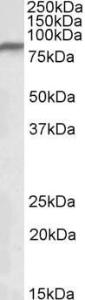 Anti-NDUFS1 Antibody (A84841) (0.3µg/ml) staining of Human Heart lysate (35µg protein in RIPA buffer). Detected by chemiluminescence.