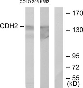 Western blot analysis of lysates from COLO205 and K562 cells using Anti-CDH2 Antibody. The right hand lane represents a negative control, where the antibody is blocked by the immunising peptide