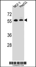 Anti-MGAT2 Rabbit Polyclonal Antibody