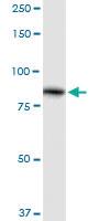 Anti-ALDH16A1 Rabbit Polyclonal Antibody