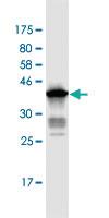 Anti-ANAPC2 Mouse Monoclonal Antibody [clone: 7F2]