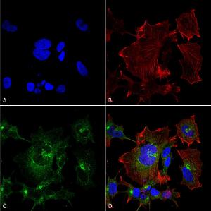 Immunocytochemistry/Immunofluorescence analysis of human neuroblastoma cell line (SK-N-BE, fixed in 4% formaldehyde for 15 min at room temperature, using Anti-NPAS4 Antibody [S408-79] (A305032), at 1:100 for 60 minutes at room temperatur