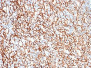 Immunohistochemical analysis of formalin-fixed, paraffin-embedded human tonsil using Anti-CD73 Antibody [NT5E/2505]