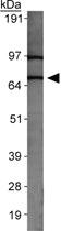 Anti-SLC31A2 Rabbit Polyclonal Antibody