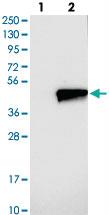 Anti-ZADH2 Rabbit Polyclonal Antibody