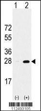 Anti-PSMA5 Rabbit Polyclonal Antibody (Biotin)