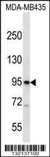 Anti-CNGB3 Rabbit Polyclonal Antibody (Biotin)