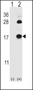 Anti-FABP4 Rabbit Polyclonal Antibody (AP (Alkaline Phosphatase))