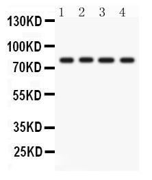 Anti-PKC eta Rabbit Polyclonal Antibody