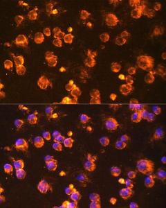 Immunofluorescence analysis of Jurkat cells using Anti-Fyn Antibody (A309065) at a dilution of 1:100 (40X lens). DAPI was used to stain the cell nuclei (blue)