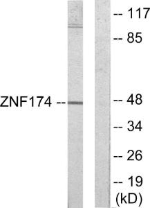 Anti-ZNF174 Rabbit Polyclonal Antibody